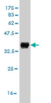 ABL2 monoclonal antibody (M03), clone 6D5