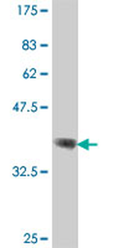 ABCA4 polyclonal antibody (A01)