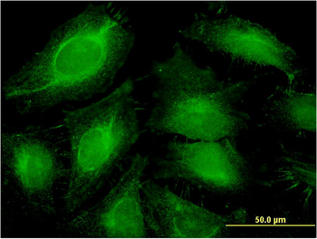 ABCF1 monoclonal antibody (M01), clone 1B4