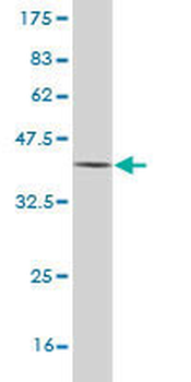 AADAC monoclonal antibody (M01), clone 2E8