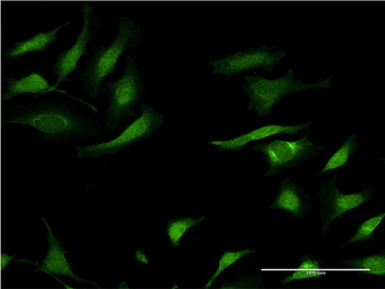 SERPINA3 monoclonal antibody (M02), clone 1C10