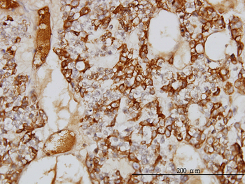 SERPINA3 monoclonal antibody (M01), clone 1E6