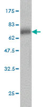 SERPINA3 monoclonal antibody (M01), clone 1E6