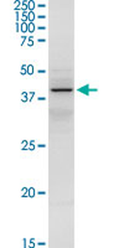 SERPINA3 purified MaxPab rabbit polyclonal antibody (D01P)