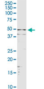 SERPINA3 purified MaxPab rabbit polyclonal antibody (D01P)