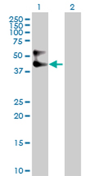 SERPINA3 purified MaxPab rabbit polyclonal antibody (D01P)