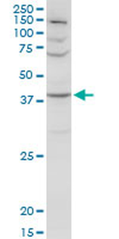 SERPINA3 MaxPab rabbit polyclonal antibody (D01)