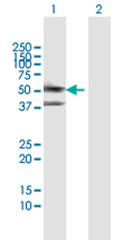 SERPINA3 MaxPab rabbit polyclonal antibody (D01)