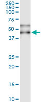 SERPINA3 MaxPab rabbit polyclonal antibody (D01)