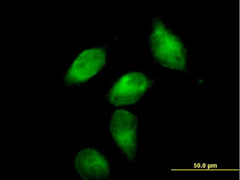 SERPINA3 purified MaxPab mouse polyclonal antibody (B01P)