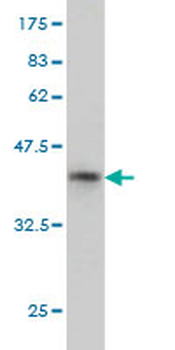 NAT2 monoclonal antibody (M01), clone 3B5