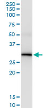 NAT2 MaxPab rabbit polyclonal antibody (D01)