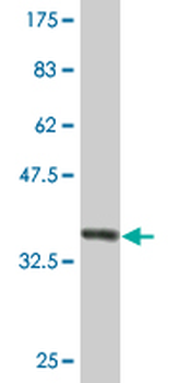 A2M monoclonal antibody (M03), clone 2B5