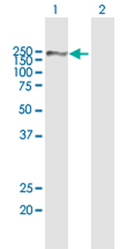 A2M MaxPab rabbit polyclonal antibody (D01)