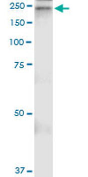 A2M MaxPab rabbit polyclonal antibody (D01)
