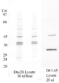 Anti-SerpinB11 Rabbit Polyclonal Antibody