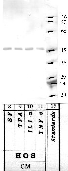 Anti-SerpinB10 Rabbit Polyclonal Antibody