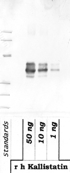 Anti-SERPINA4 Rabbit Polyclonal Antibody