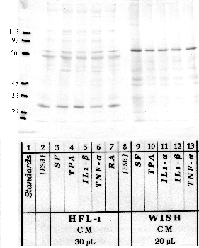 Anti-RECK Rabbit Polyclonal Antibody