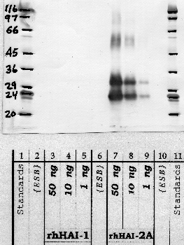Anti-SPINT2 Rabbit Polyclonal Antibody