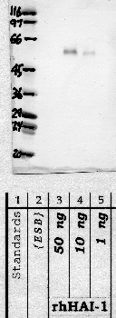 Anti-SPINT1 Rabbit Polyclonal Antibody