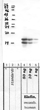 Anti-PI3 Rabbit Polyclonal Antibody