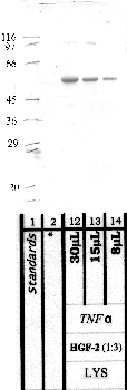 Anti-TMPRSS11F Rabbit Polyclonal Antibody