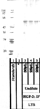 Anti-TMPRSS11F Rabbit Polyclonal Antibody