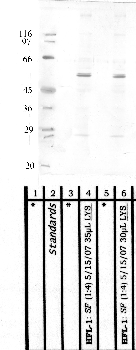Anti-TMPRSS11F Rabbit Polyclonal Antibody