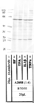 Anti-TMPRSS11E Rabbit Polyclonal Antibody