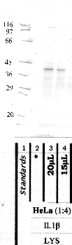 Anti-TMPRSS11B Rabbit Polyclonal Antibody