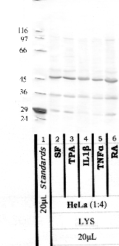 Anti-TMPRSS11B Rabbit Polyclonal Antibody