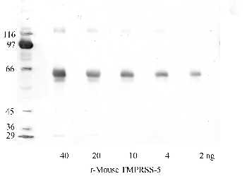Anti-TMPRSS5 Rabbit Polyclonal Antibody