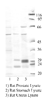 Anti-TMPRSS5 Rabbit Polyclonal Antibody