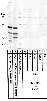 Anti-MBTPS1 Rabbit Polyclonal Antibody