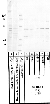 Anti-MBTPS1 Rabbit Polyclonal Antibody