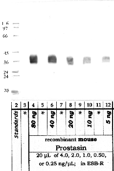 Anti-PRSS8 Rabbit Polyclonal Antibody
