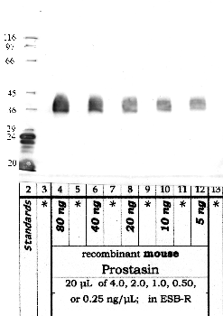 Anti-PRSS8 Rabbit Polyclonal Antibody