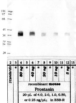 Anti-PRSS8 Rabbit Polyclonal Antibody