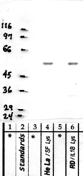 Anti-PRSS53 Rabbit Polyclonal Antibody