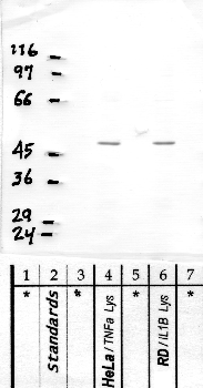 Anti-PRSS53 Rabbit Polyclonal Antibody
