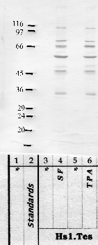 Anti-TMPRSS9 Rabbit Polyclonal Antibody