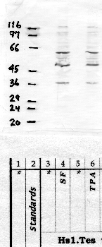Anti-TMPRSS9 Rabbit Polyclonal Antibody