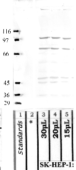 Anti-MASP2 Rabbit Polyclonal Antibody