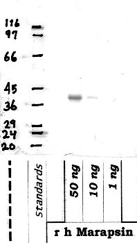 Anti-PRSS27 Rabbit Polyclonal Antibody