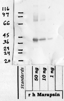 Anti-PRSS27 Rabbit Polyclonal Antibody