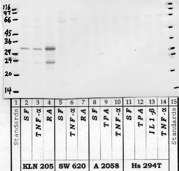 Anti-KLK15 Rabbit Polyclonal Antibody