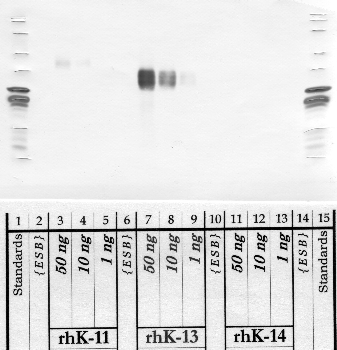 Anti-KLK13 Rabbit Polyclonal Antibody