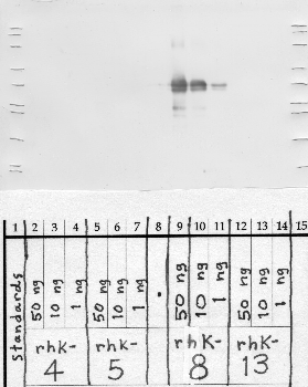 Anti-KLK8 Rabbit Polyclonal Antibody