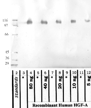Anti-HGFAC Rabbit Polyclonal Antibody
